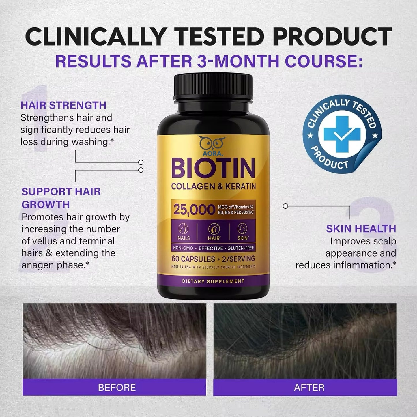 Biotin | Hyaluronic Acid | Collagen | Keratin Supplement